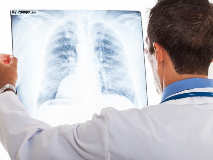 1700 décès imputés chaque année à l'amiante