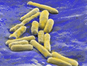 Réseaux d'eau chaude : détruire les légionelles